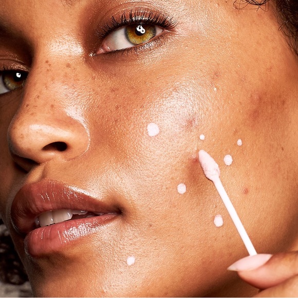 ✨Kate Somerville ERADIKATE® ACNE TREATMENT - Picture 3 of 11